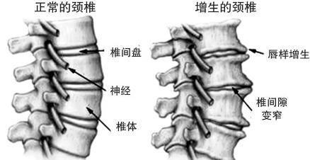 中醫(yī)帶你走進頸椎病.jpg