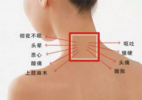 你的頸椎還健康嗎？