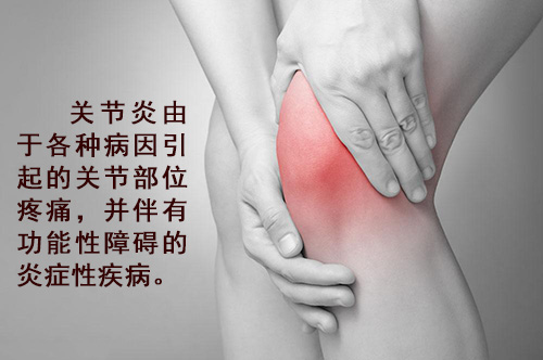 關(guān)節(jié)炎的并發(fā)癥你可知曉？